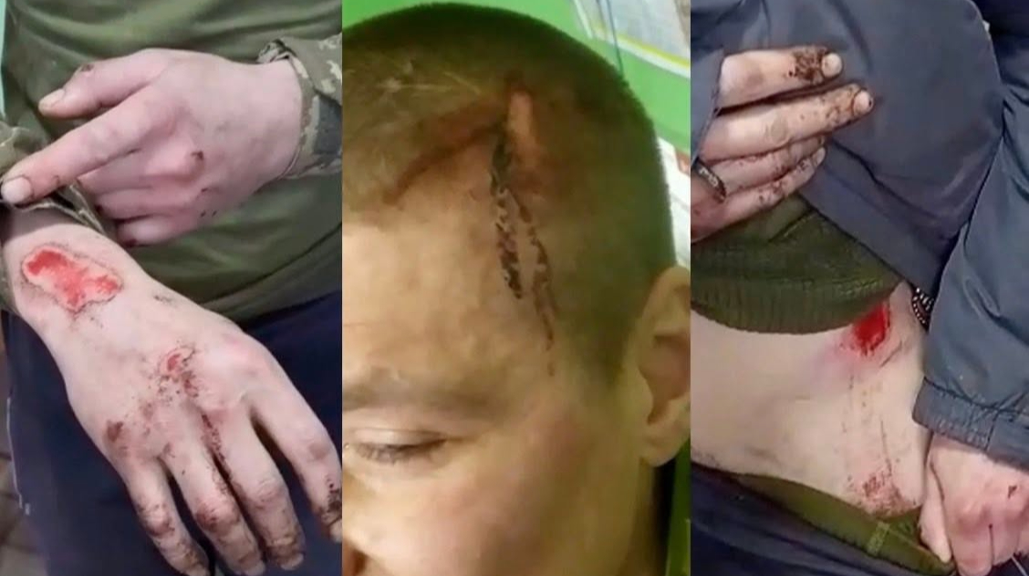 26 небоевых смертей в полку "Скала"